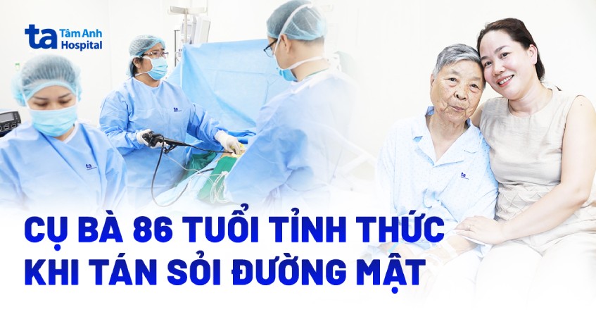 Cụ bà 86 tuổi tỉnh thức khi tán sỏi đường mật