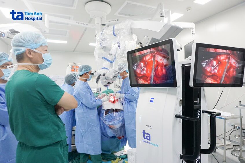 theo dõi hình ảnh mạch máu não dị dạng