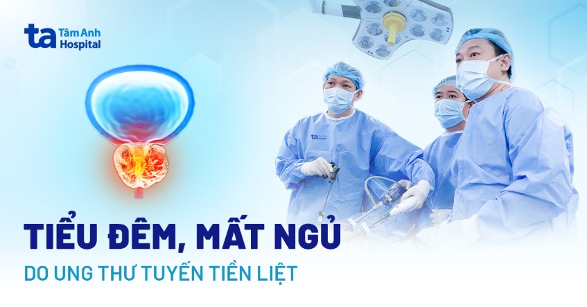 Tiểu đêm, mất ngủ 5 năm do ung thư tuyến tiền liệt