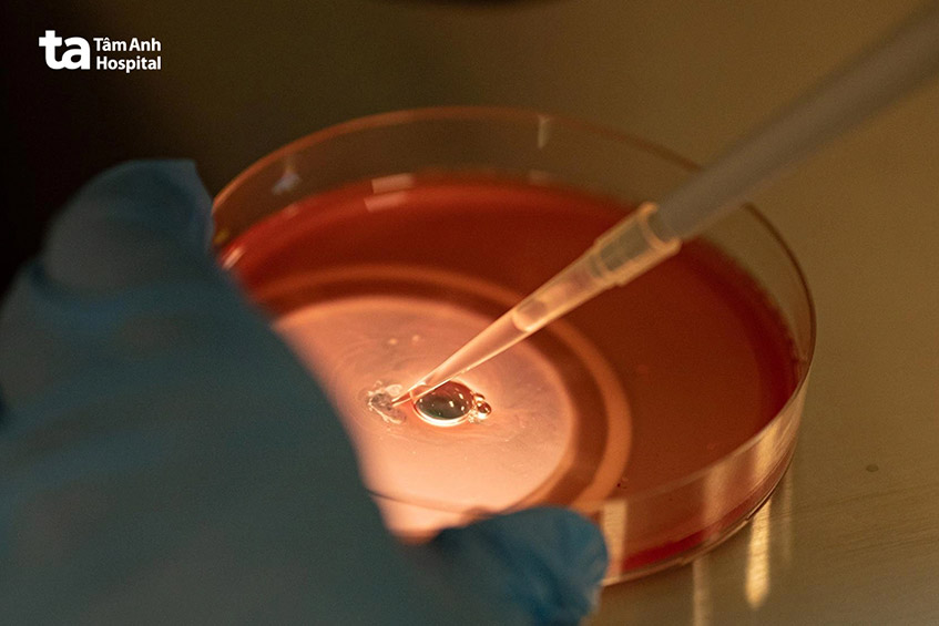 trứng được chọc hút chuyển vào phòng thí nghiệm