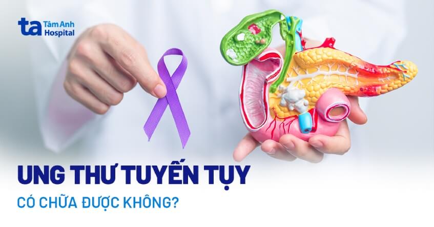 ung thư tuyến tụy có chữa được không