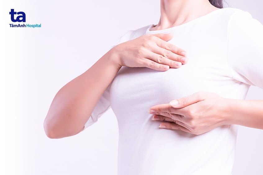 ung thư vú ở phụ nữ trẻ tuổi