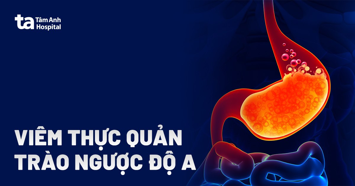Viêm thực quản trào ngược độ A: Nguyên nhân, dấu hiệu và điều trị