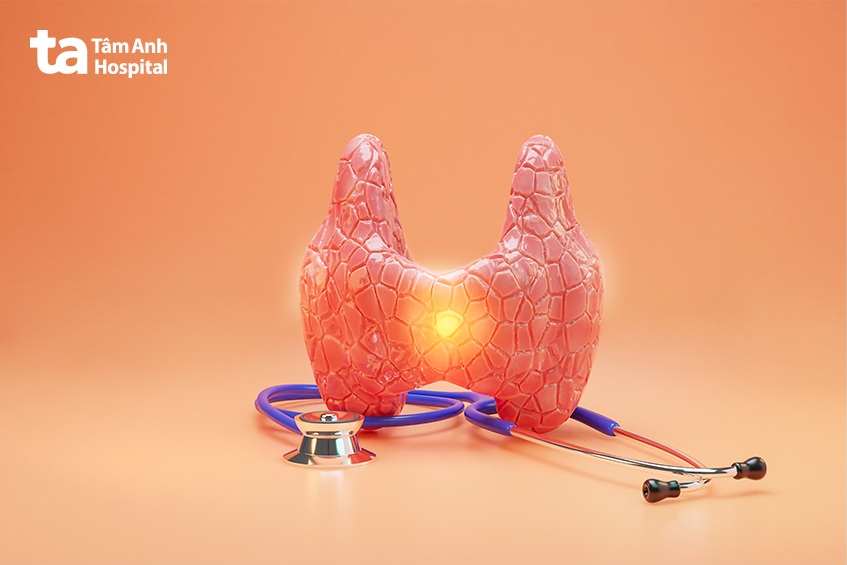 Viêm tuyến giáp bán cấp là bệnh xảy ra cấp tính