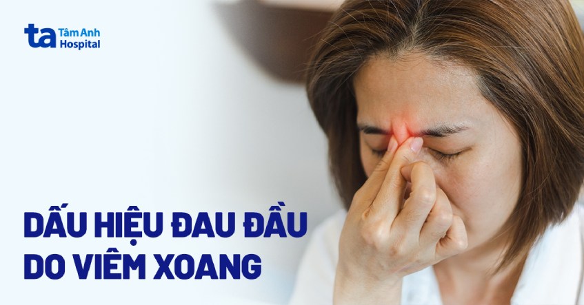 viêm xoang nhức đầu