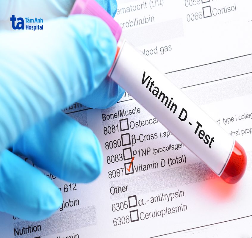 Xét nghiệm kiểm tra nồng độ vitamin D