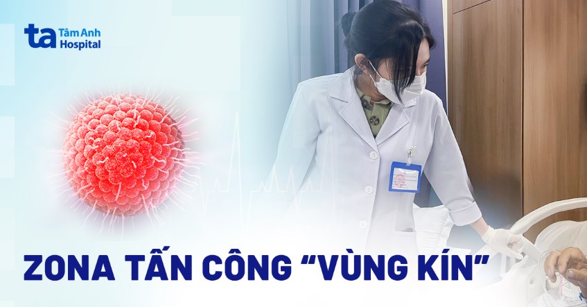 Lên cơn co giật vì zona tấn công “vùng kín”