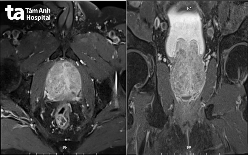 hình ảnh chụp cộng hưởng