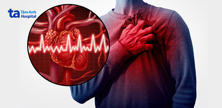 Biến chứng nhồi máu cơ tim do rối loạn lipid máu gây ra