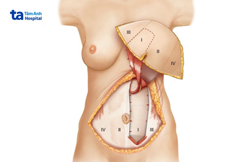 Chăm sóc người bệnh toàn diện