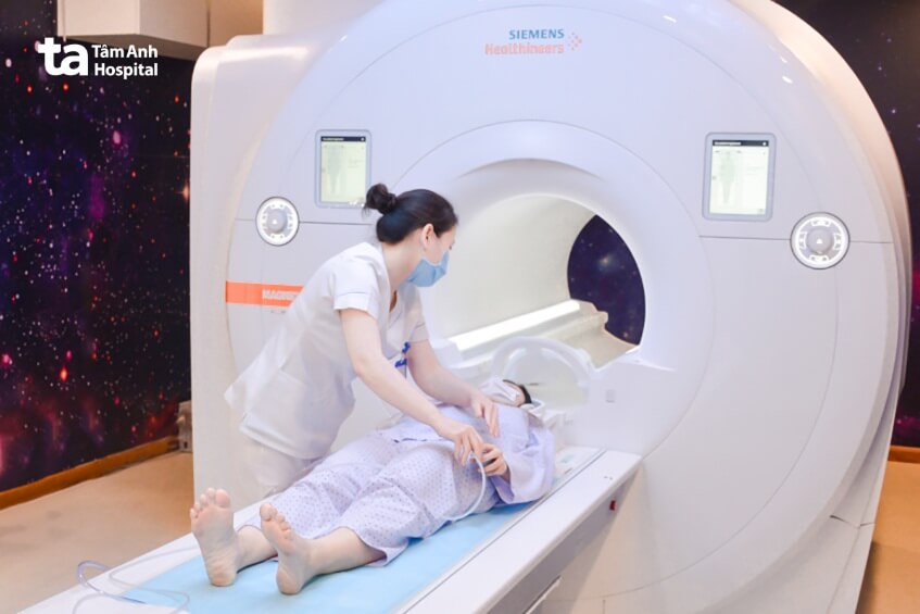 chẩn đoán hình ảnh u thần kinh đệm bậc thấp