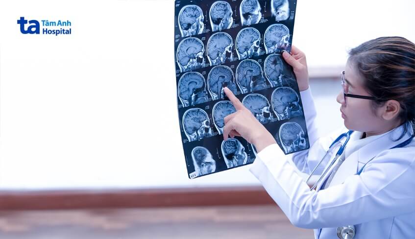 chẩn đoán nhiễm trùng não