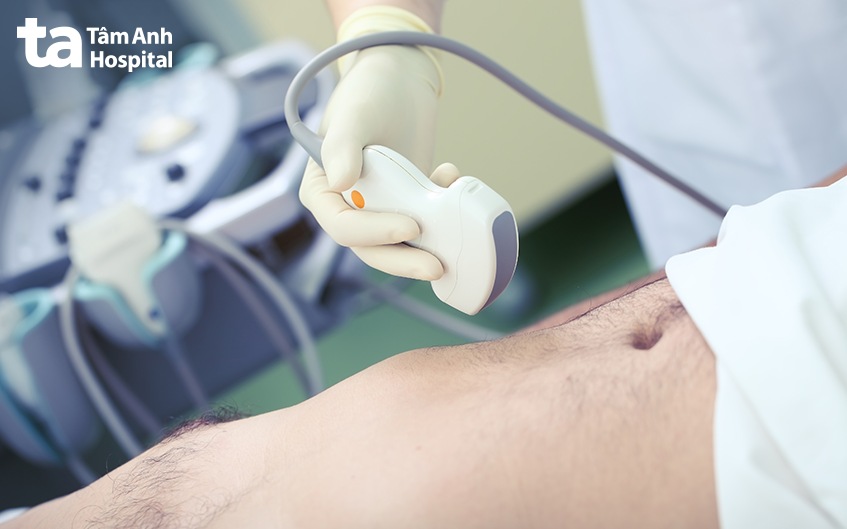 chẩn đoán vỡ túi mật