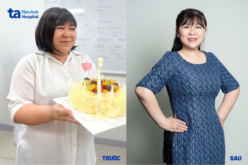 chị loan hết gan nhiễm mỡ và béo phì