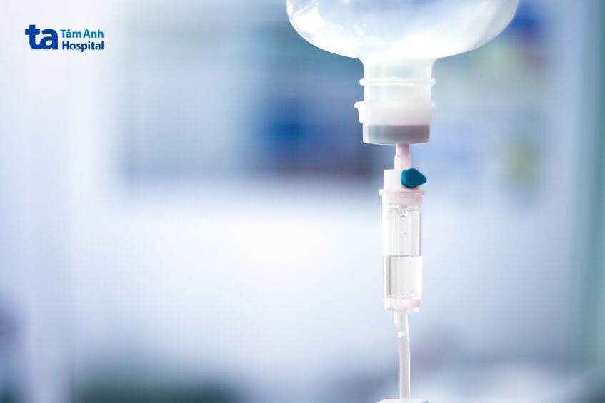 điều trị u thần kinh đệm cầu não lan tỏa