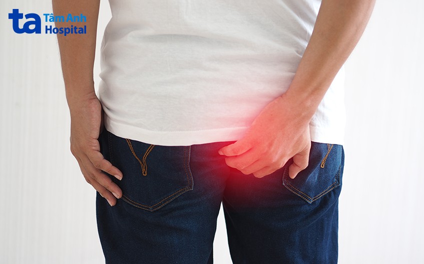 đối tượng cần phẫu thuật trĩ longo