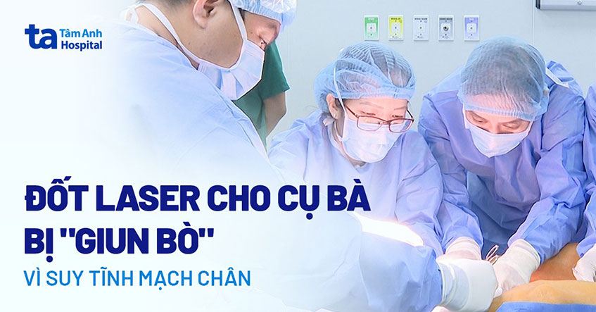 Tĩnh mạch suy giãn nổi ngoằn ngoèo trên chân
