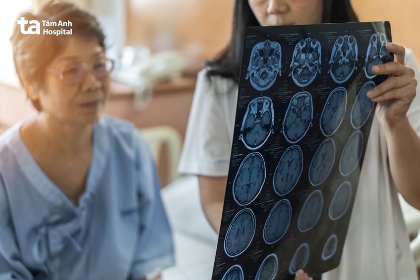 hình ảnh chẩn đoán bệnh viêm xương sọ