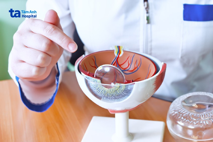 kỹ thuật siêu âm mắt