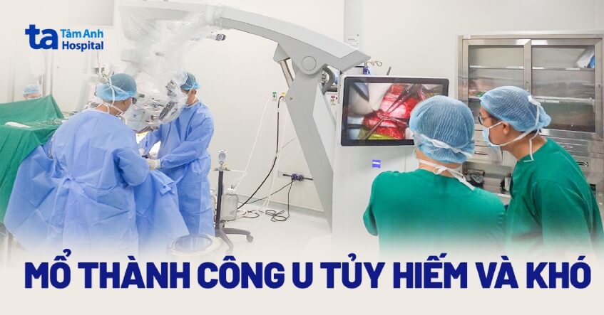 U tủy sống 4 cm đẩy lệch tủy và dây thần kinh