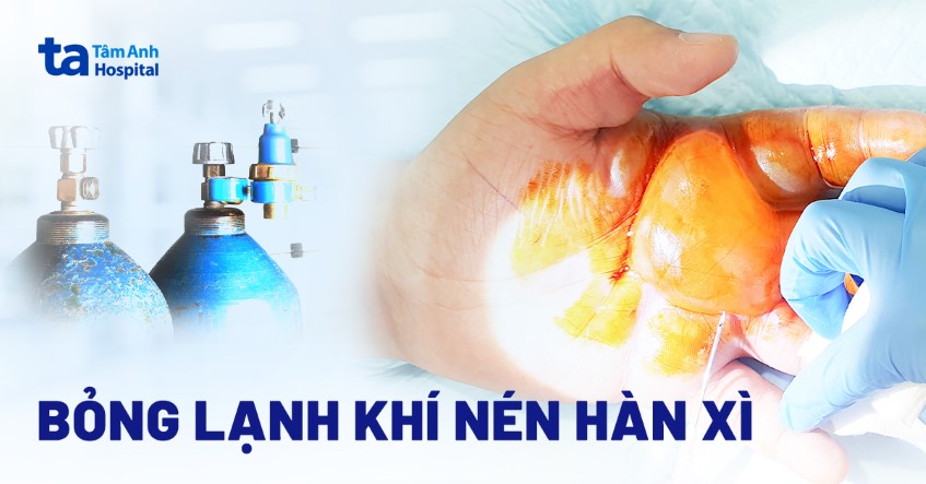 Nam sinh bị bỏng khi mở van bình oxy