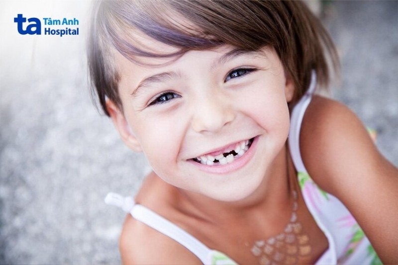 Có nên tự nhổ răng sữa cho bé?