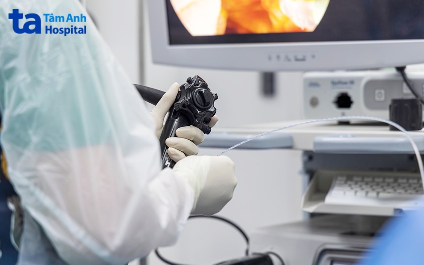 nội soi barrett thực quản