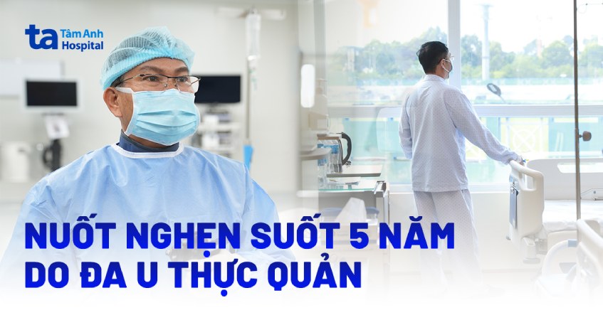 Nuốt nghẹn suốt 5 năm do đa u thực quản