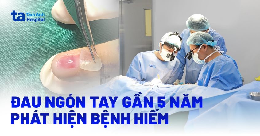 Đau ngón tay gần 5 năm, phát hiện bệnh hiếm