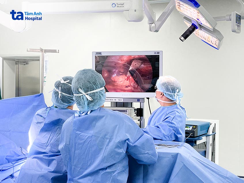 Phẫu thuật lõm ngực bằng phương pháp xâm lấn tối thiểu