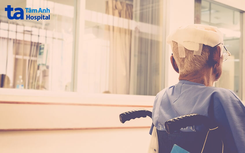 phương pháp phẫu thuật ghép sọ nhân tạo