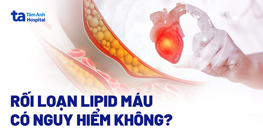 Rối loạn lipid máu có nguy hiểm không? Biến chứng thường gặp nhất