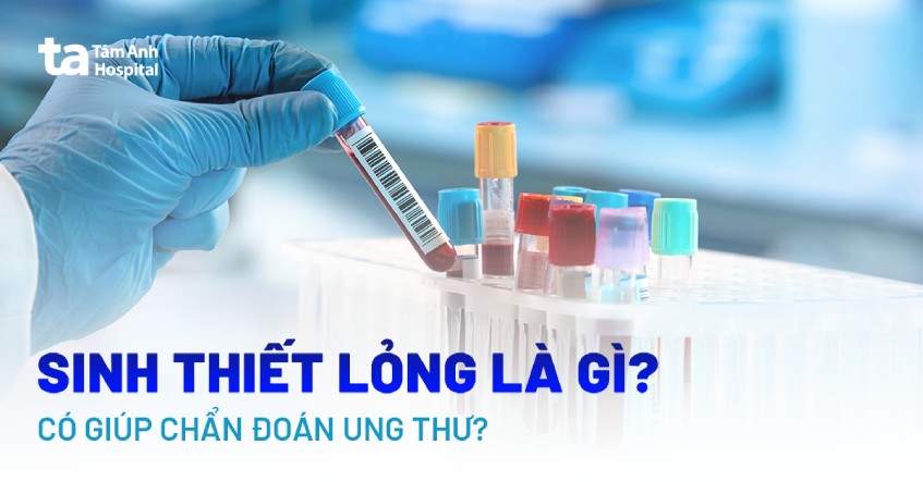 sinh thiết lỏng là gì
