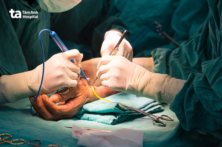 Tiếp cận đường vào mạch máu bằng cầu nối tự thân