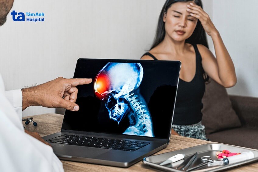 triệu chứng viêm xương sọ