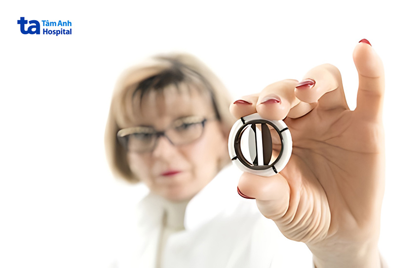 Van cơ học được nhiều bệnh nhân lựa chọn vì chi phí hợp lý