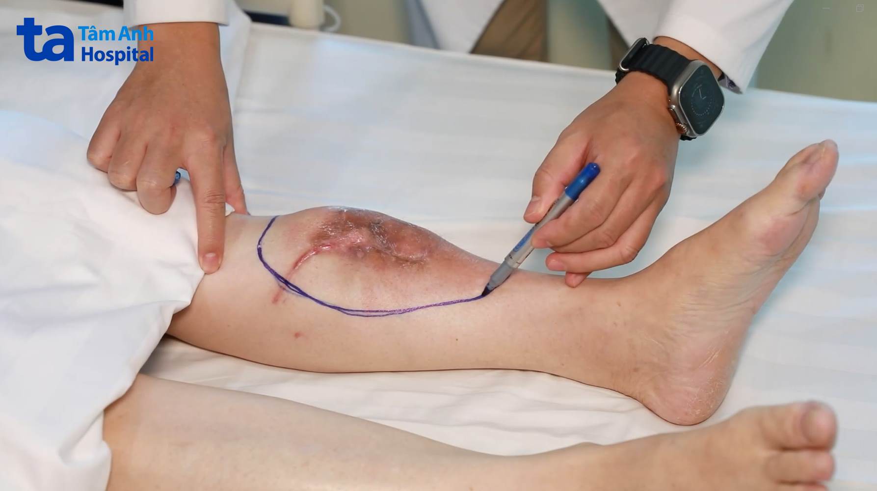 Dik mushukni yaqin planda sikayapti