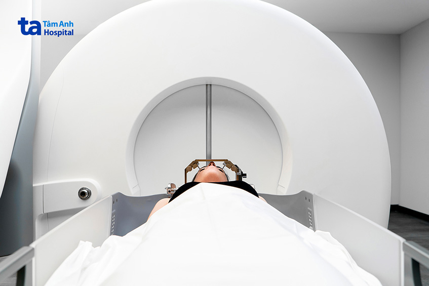 Xạ phẫu Gamma Knife có thể giúp điều trị dị dạng mạch máu não hiệu quả