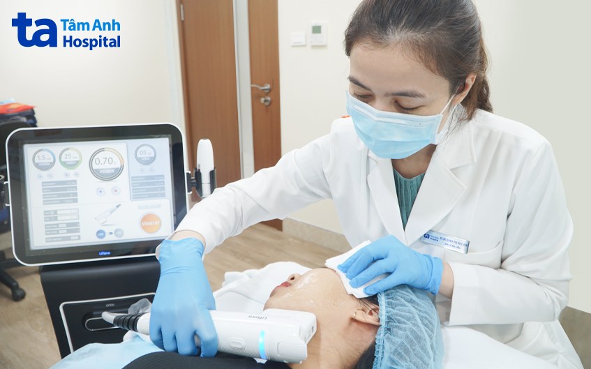 bác sĩ bích vân xóa nếp nhăn bằng máy hifu