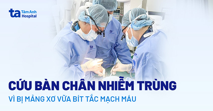 Mạch máu chân có mảng xơ vữa cứng như vỏ trứng