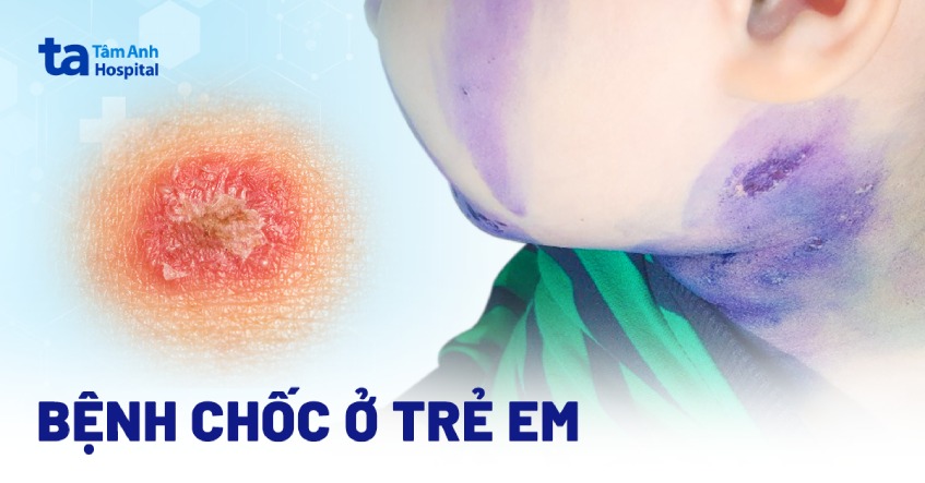 Bé trai nổi chốc khắp người