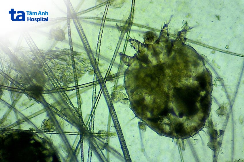 Cái ghẻ dưới kính hiển vi