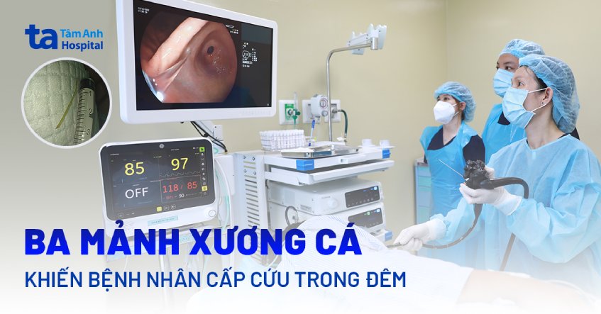 Ba mảnh xương cá khiến người phụ nữ đau bụng dữ dội