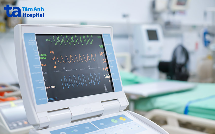 Chẩn đoán hồi hộp đánh trống ngực bằng kỹ thuật đo điện tâm đồ