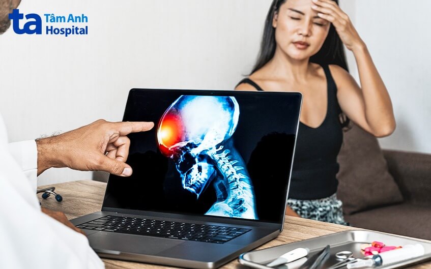 chỉ định phẫu thuật viêm xương sọ