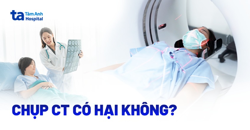 chụp cắt lớp có hại không