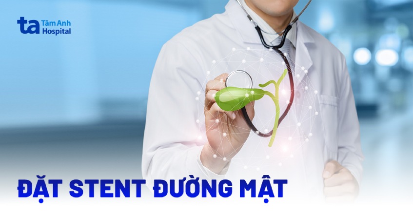 đặt stent đường mật