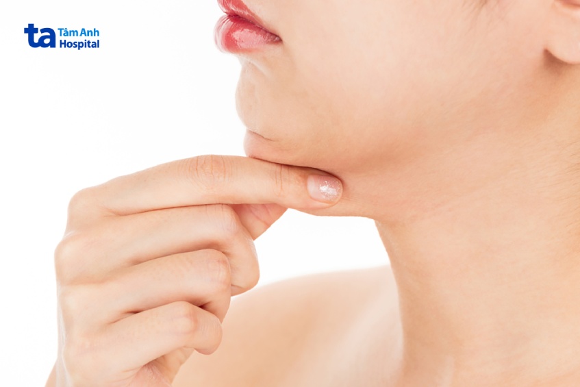 dấu hiệu nhận biết nọng cằm