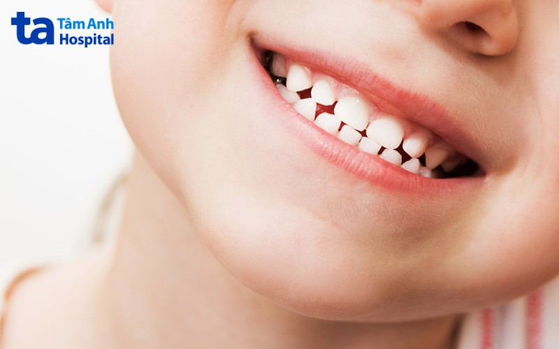 Thay răng sữa ở trẻ em khi nào cần đến nha sĩ?