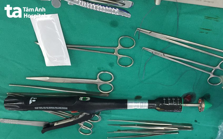 dụng cụ cắt trĩ Milligan Morgan